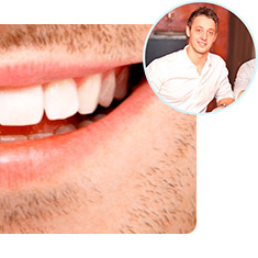 Избелване на зъби Dental Whitestrips