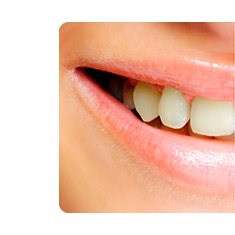 Избелване на зъби Dental Whitestrips